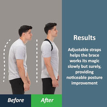 Load image into Gallery viewer, ComfyBrace Posture Corrector-Back Brace for Men and Women- Fully Adjustable Straightener for Mid, Upper Spine Support- Neck, Shoulder, Clavicle and Back Pain Relief-Breathable