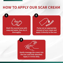 Load image into Gallery viewer, Protect Life Silicone Scar Cream for Scars, Injury & Keloid Scars. Moisturising, Rejuvenating Silicone Scar Cream for Old & New Scars, Non-Greasy