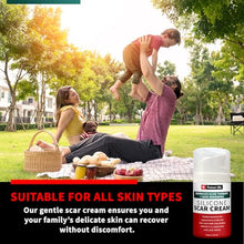 Load image into Gallery viewer, Protect Life Silicone Scar Cream for Scars, Injury & Keloid Scars. Moisturising, Rejuvenating Silicone Scar Cream for Old & New Scars, Non-Greasy