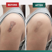 Load image into Gallery viewer, Protect Life Silicone Scar Cream for Scars, Injury &amp; Keloid Scars. Moisturising, Rejuvenating Silicone Scar Cream for Old &amp; New Scars, Non-Greasy
