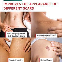 Load image into Gallery viewer, Medical-Grade Silicone Scar Tape Roll (1.6" x 118") Keloid Bump Removal Scar Sheets - Reusable Silicone Tape Scar Removal Strips, Scar Tape for Surgical Scars, C Section Scar Silicone Strips (2 Pack)
