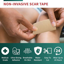 Load image into Gallery viewer, Medical-Grade Silicone Scar Tape Roll (1.6" x 118") Keloid Bump Removal Scar Sheets - Reusable Silicone Tape Scar Removal Strips, Scar Tape for Surgical Scars, C Section Scar Silicone Strips (2 Pack)
