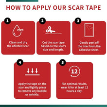 Load image into Gallery viewer, Protect Life Silicone Scar Sheets 1.6" x 118" Roll-3M - Medical Grade Scar Tape for Keloid Bump Removal - Reusable Silicone Tape Scar Removal Strips, Patches for Surgical Scars, C Section
