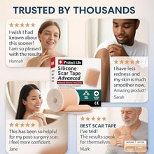Load image into Gallery viewer, Medical Grade Silicone Scar Tape Advanced Adhesive Formulation (1.6" x 118") Scar Removal Away Strips for Surgical Scars, Silicone Tape &amp; Keloid Scar Treatment, Reusable Silicone Scar Sheets
