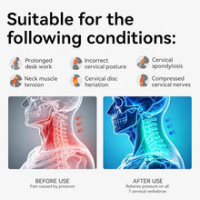 Load image into Gallery viewer, Owlprince Posture Corrector for Neck &amp; Cervical Spine Alignment - Memory Foam Support for Pain Relief, Tech Neck, 360° Adjustable Neck Collar, (White, Large)
